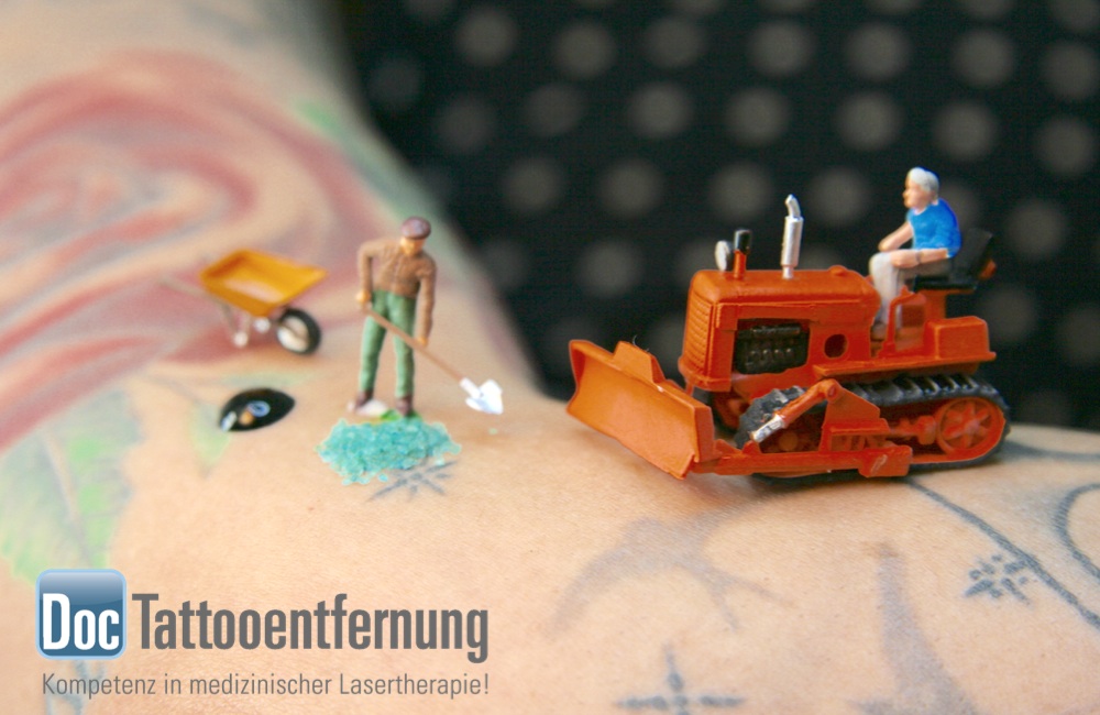 Die Tattooentfernung dargestellt als Baustelle mit Spielfiguren und kleinem Bagger.